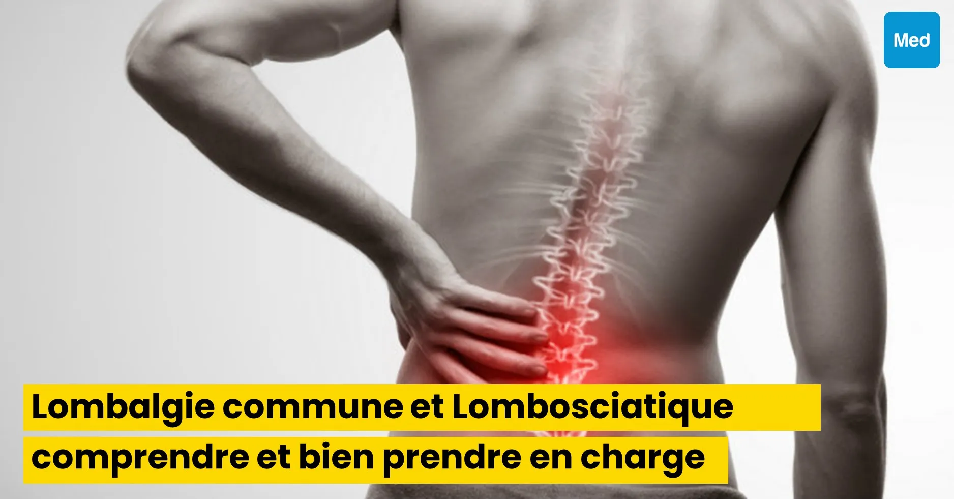 Prise en charge de la lombalgie commune et de la lombosciatique